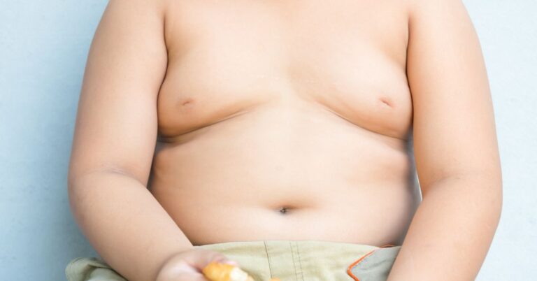 child obesity - Kjohealth