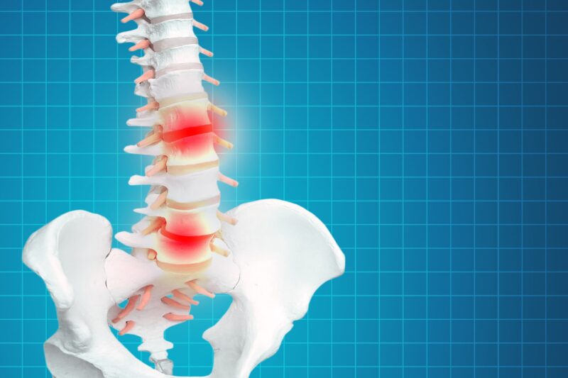 Spinal Disc Replacement