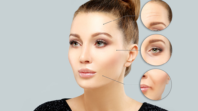 How Botox Injections Smooth Fine Lines and Wrinkles Naturally